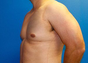 RGV Cosmetic Surgery Vein Care 