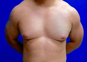 RGV Cosmetic Surgery Vein Care 
