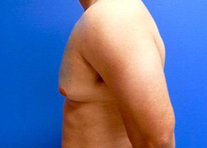 RGV Cosmetic Surgery Vein Care 
