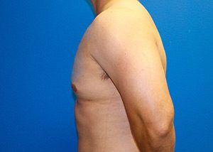RGV Cosmetic Surgery Vein Care 