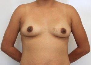 RGV Cosmetic Surgery Vein Care 