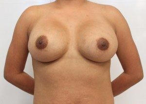 RGV Cosmetic Surgery Vein Care 