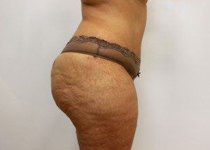RGV Cosmetic Surgery Vein Care 
