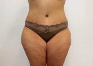 RGV Cosmetic Surgery Vein Care 
