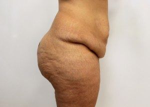 RGV Cosmetic Surgery Vein Care 