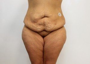 RGV Cosmetic Surgery Vein Care 
