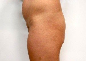 RGV Cosmetic Surgery Vein Care 