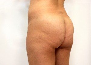 RGV Cosmetic Surgery Vein Care 