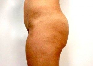 RGV Cosmetic Surgery Vein Care 