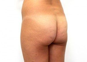 RGV Cosmetic Surgery Vein Care 