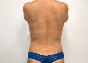 RGV Cosmetic Surgery Vein Care 