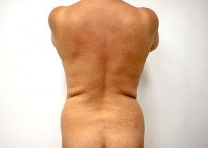 RGV Cosmetic Surgery Vein Care 