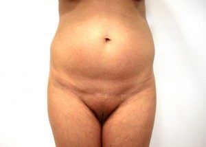 RGV Cosmetic Surgery Vein Care 