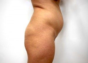 RGV Cosmetic Surgery Vein Care 