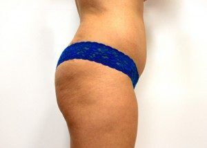 RGV Cosmetic Surgery Vein Care 