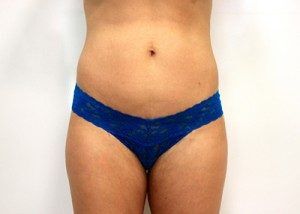 RGV Cosmetic Surgery Vein Care 