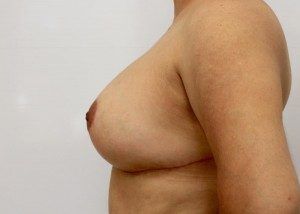 RGV Cosmetic Surgery Vein Care 