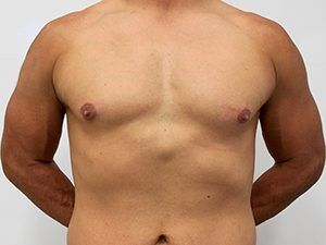 RGV Cosmetic Surgery Vein Care 