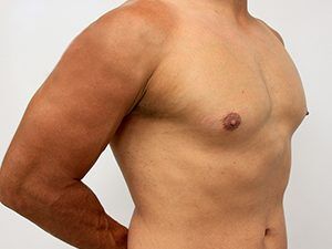 RGV Cosmetic Surgery Vein Care 