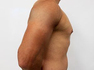 RGV Cosmetic Surgery Vein Care 