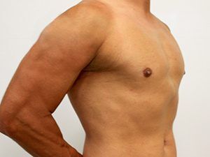 RGV Cosmetic Surgery Vein Care 