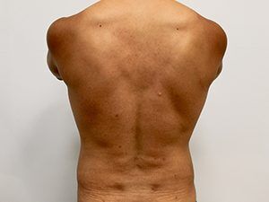 RGV Cosmetic Surgery Vein Care 