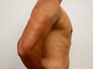 RGV Cosmetic Surgery Vein Care 