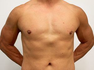 RGV Cosmetic Surgery Vein Care 