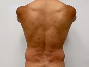 RGV Cosmetic Surgery Vein Care 