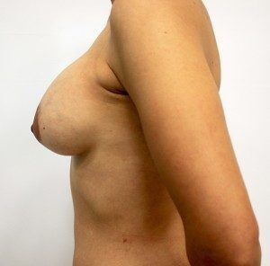 RGV Cosmetic Surgery Vein Care 