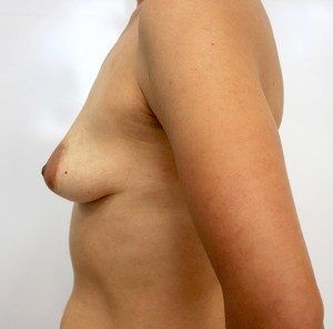 RGV Cosmetic Surgery Vein Care 