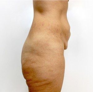RGV Cosmetic Surgery Vein Care 