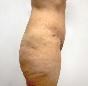 RGV Cosmetic Surgery Vein Care 