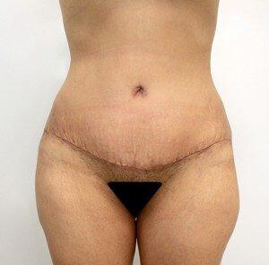 RGV Cosmetic Surgery Vein Care 