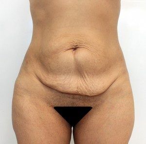 RGV Cosmetic Surgery Vein Care 