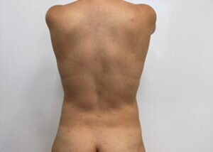 RGV Cosmetic Surgery Vein Care 