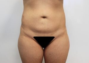 RGV Cosmetic Surgery Vein Care 