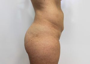 RGV Cosmetic Surgery Vein Care 