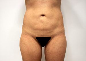 RGV Cosmetic Surgery Vein Care 