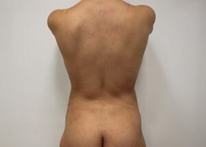 RGV Cosmetic Surgery Vein Care 