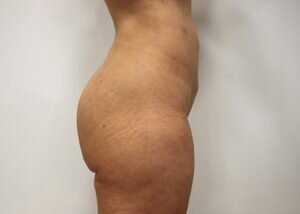 RGV Cosmetic Surgery Vein Care 