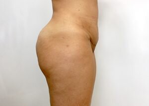 RGV Cosmetic Surgery Vein Care 