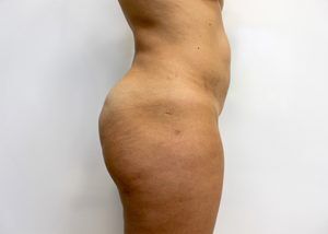 RGV Cosmetic Surgery Vein Care 