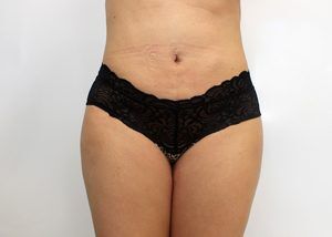 RGV Cosmetic Surgery Vein Care 