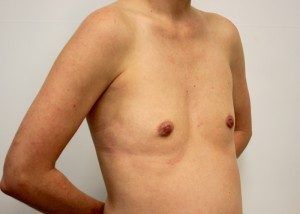 RGV Cosmetic Surgery Vein Care 