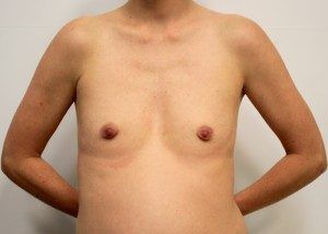 RGV Cosmetic Surgery Vein Care 