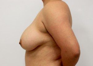 RGV Cosmetic Surgery Vein Care 