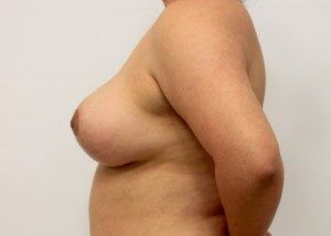 RGV Cosmetic Surgery Vein Care 