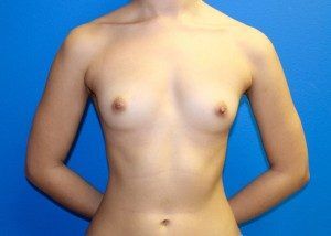 RGV Cosmetic Surgery Vein Care 