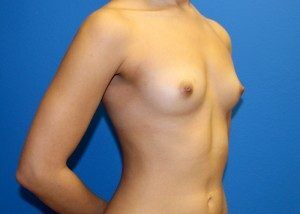 RGV Cosmetic Surgery Vein Care 
